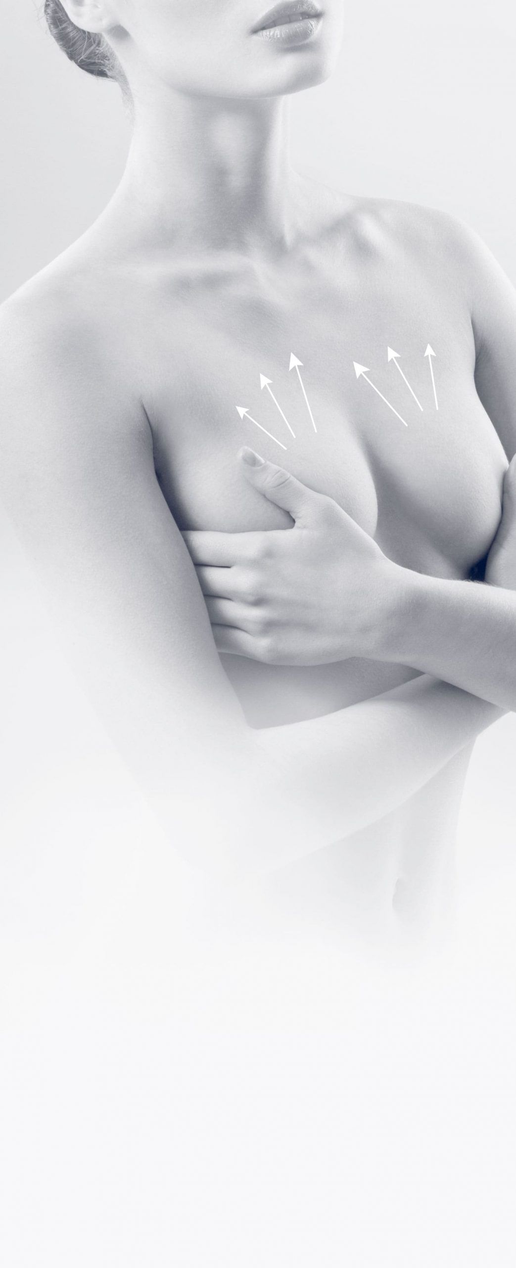 Lifting des seins à Cannes - Correction de la ptose mammaire - Dr Laveaux