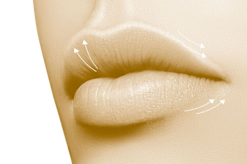 Cosmetic lip surgery in Cannes - French Riviera - Docteur Laveaux 